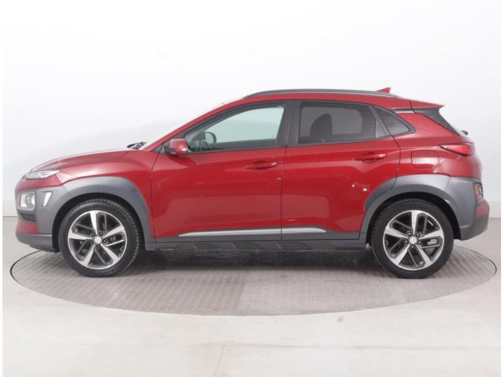 2018 Hyundai KONA - 3