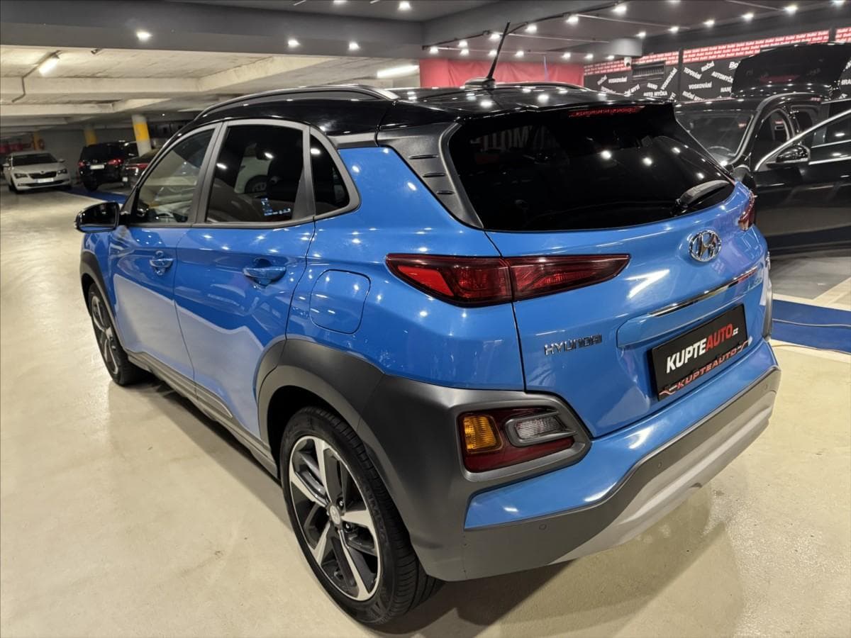 2018 Hyundai KONA - 3