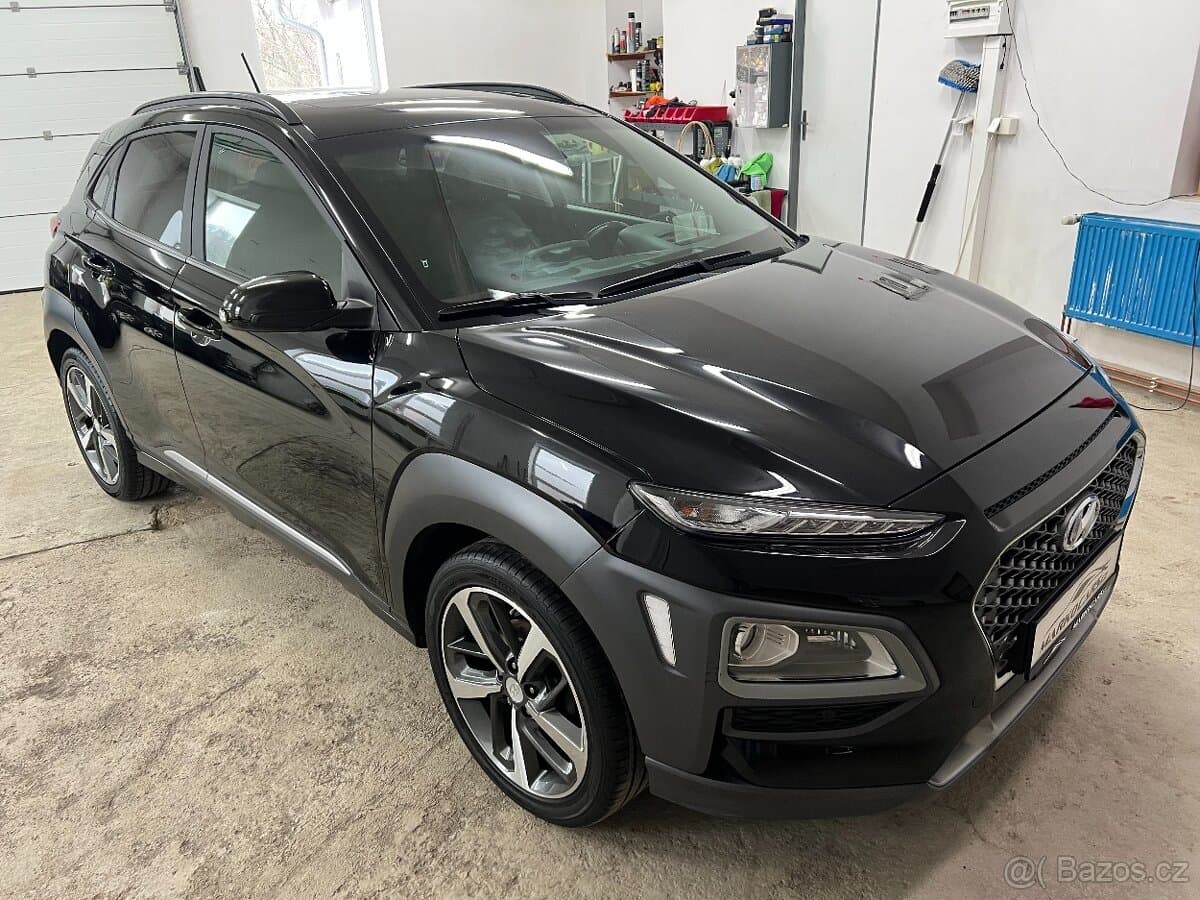 2017 Hyundai KONA - 3