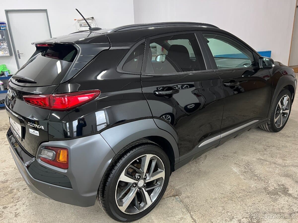 2017 Hyundai KONA - 5